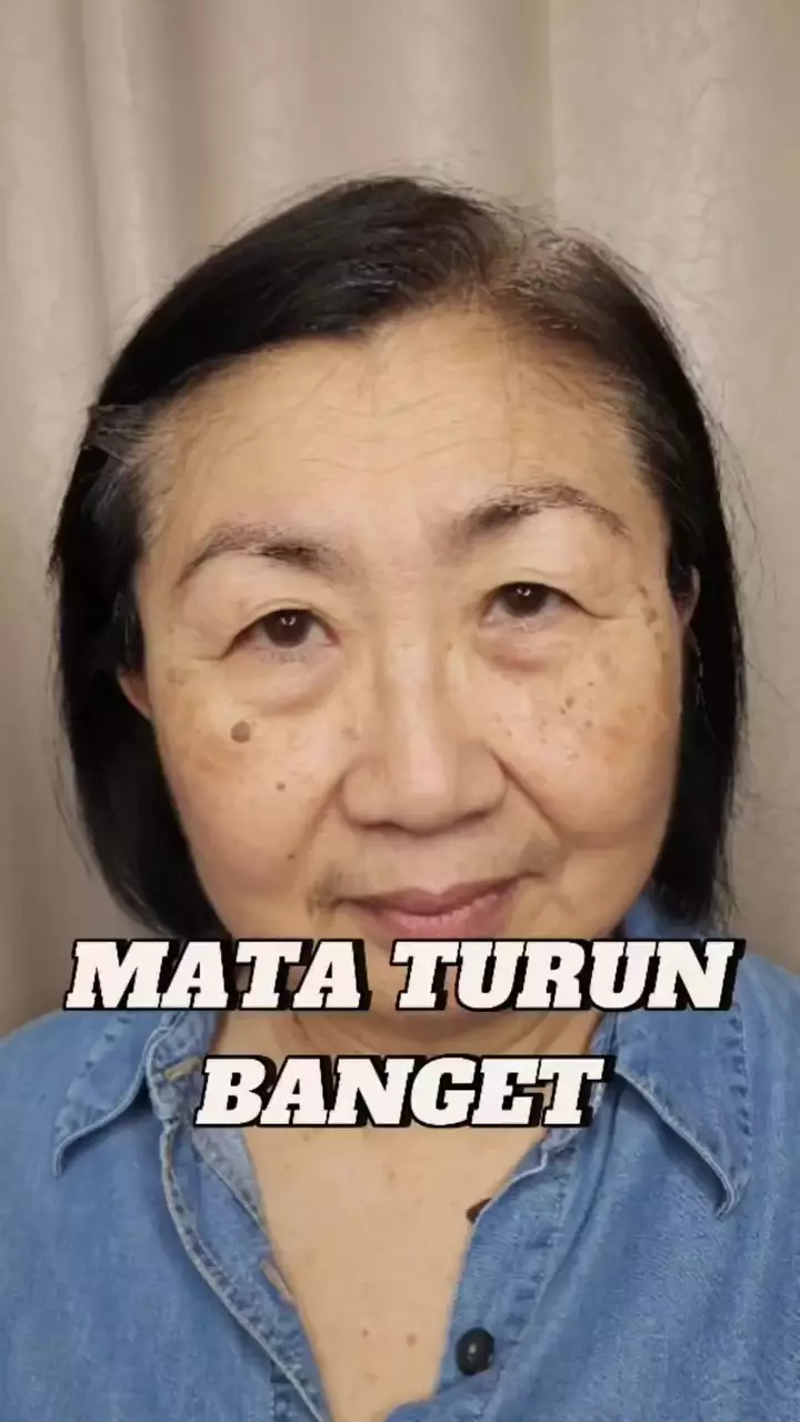 Kelopak mata turun akibat kulit kendur © Instagram Kelopak mata turun akibat kulit kendur © Instagram