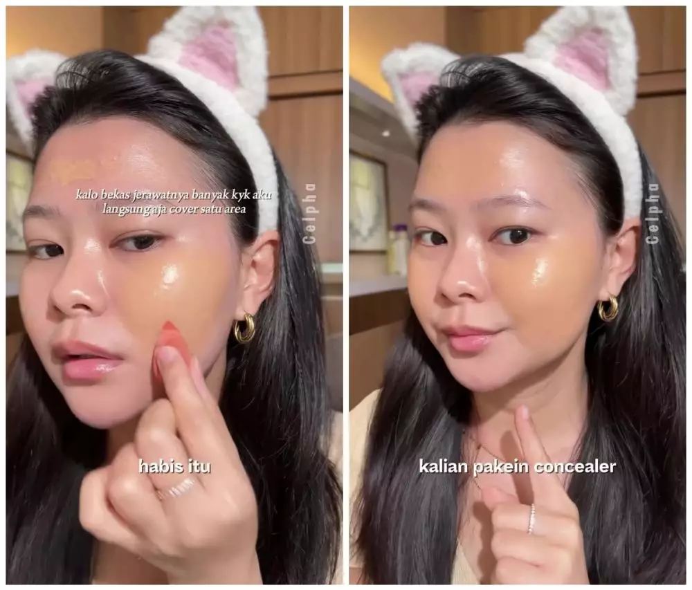 Concealer malah bikin bekas jerawat makin © Instagram  Concealer malah bikin bekas jerawat makin © Instagram