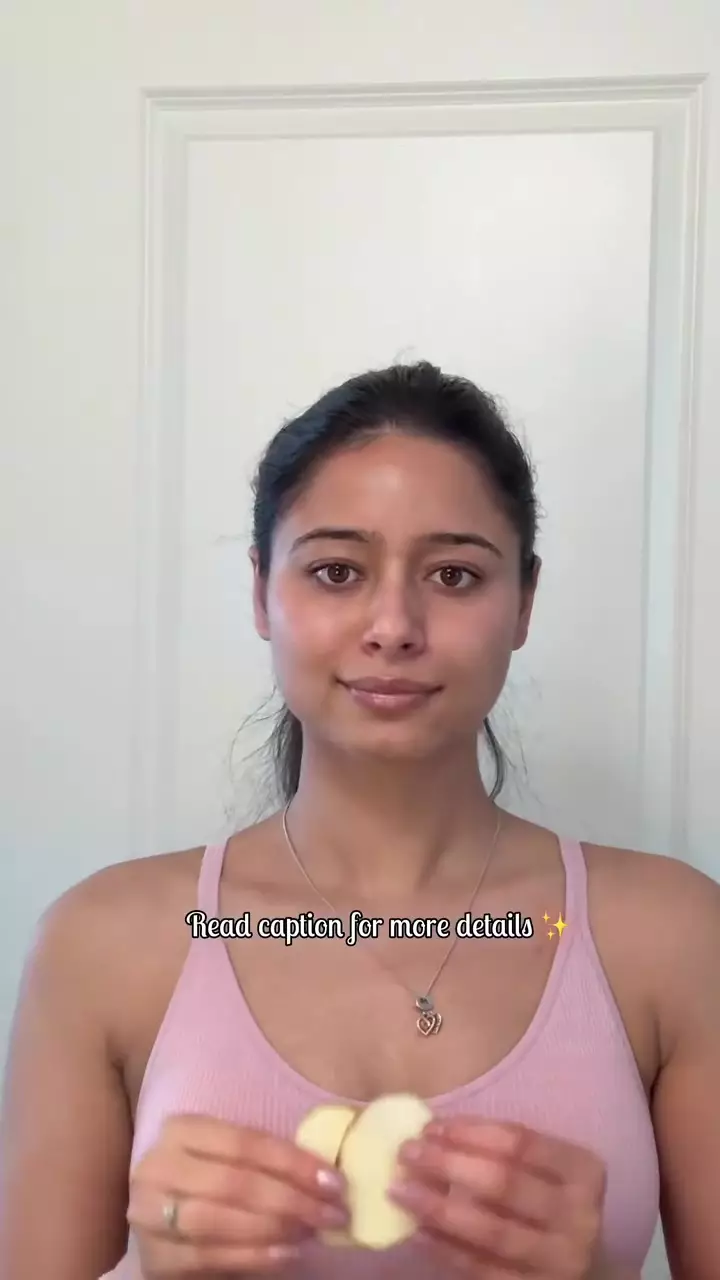 Cara baru hilangkan flek hitam © Instagram