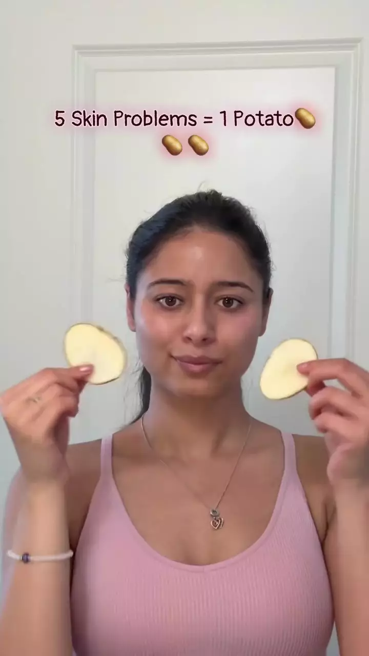 Cara baru hilangkan flek hitam © Instagram