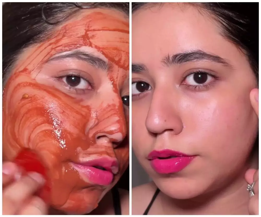 Bruntusan auto hilang © Instagram Bruntusan auto hilang © Instagram