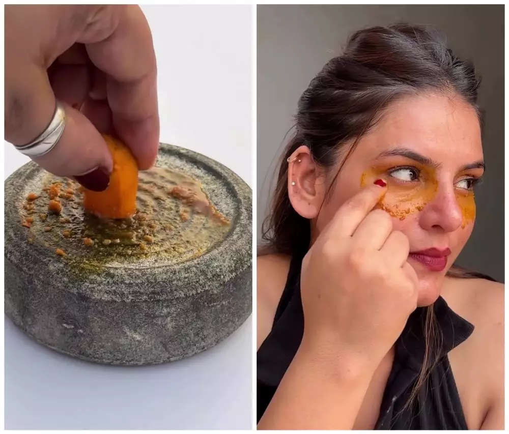 Cara hilangkan garis halus dan lingkaran hitam © Instagram Cara hilangkan garis halus dan lingkaran hitam © Instagram