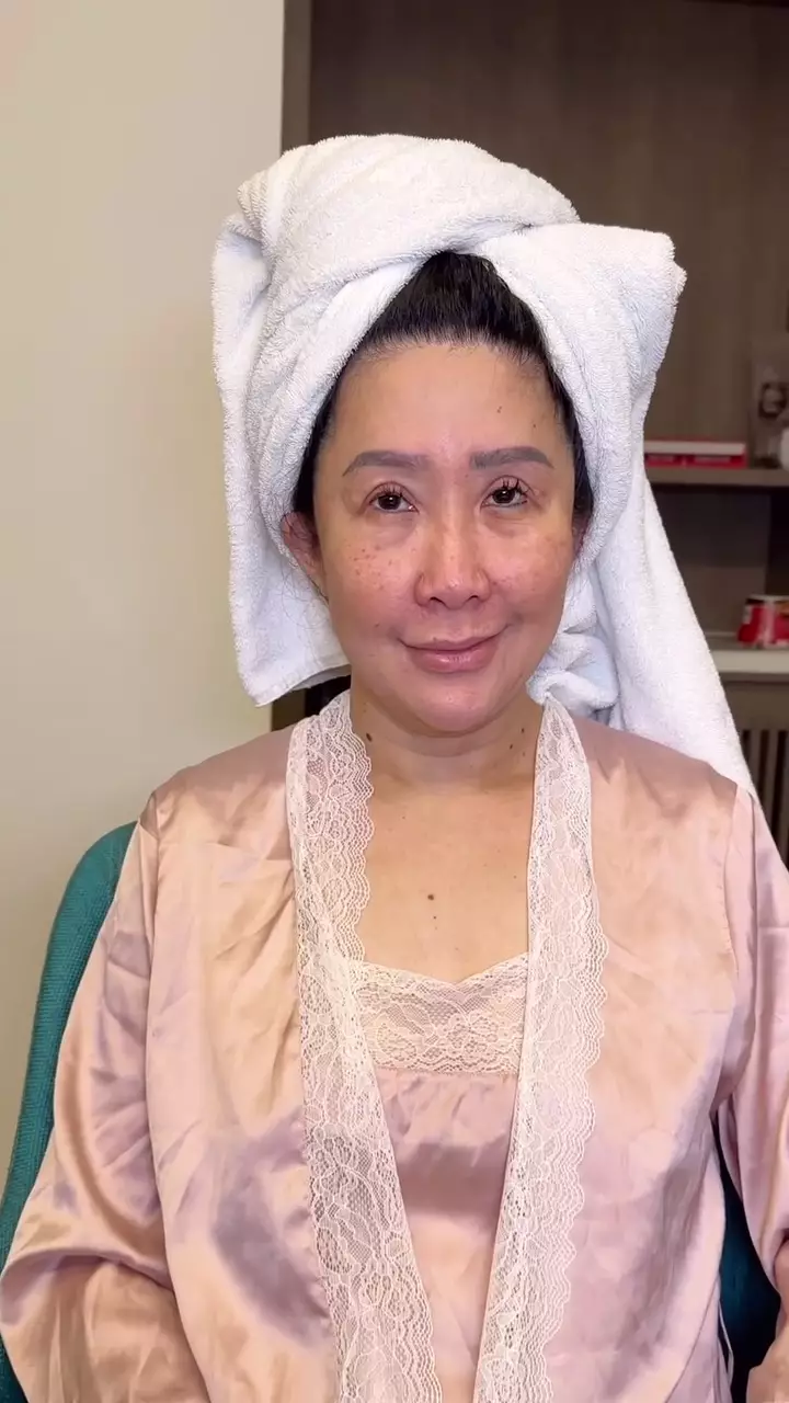 Transformasi emak-emak berflek hitam © Instagram