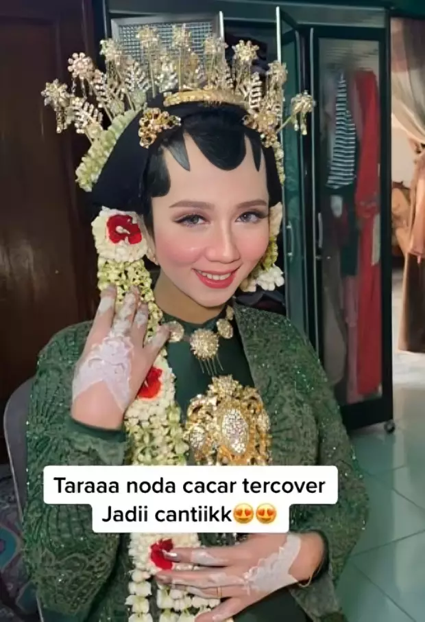 Transformasi makeup pengantin dengan bekas cacar ini bikin takjub © 2025 berbagai sumber