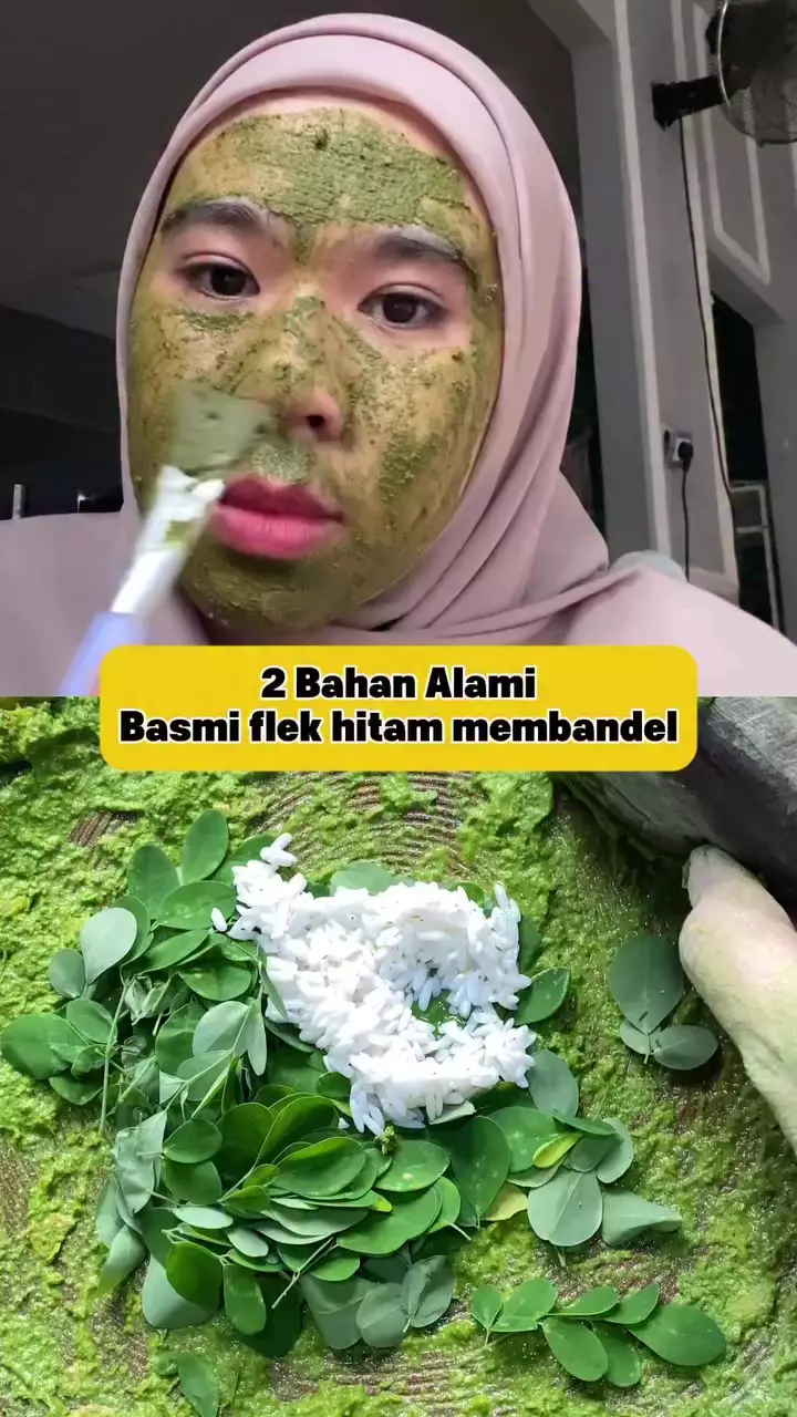 Flek hitam di wajah susah hilang © Instagram 