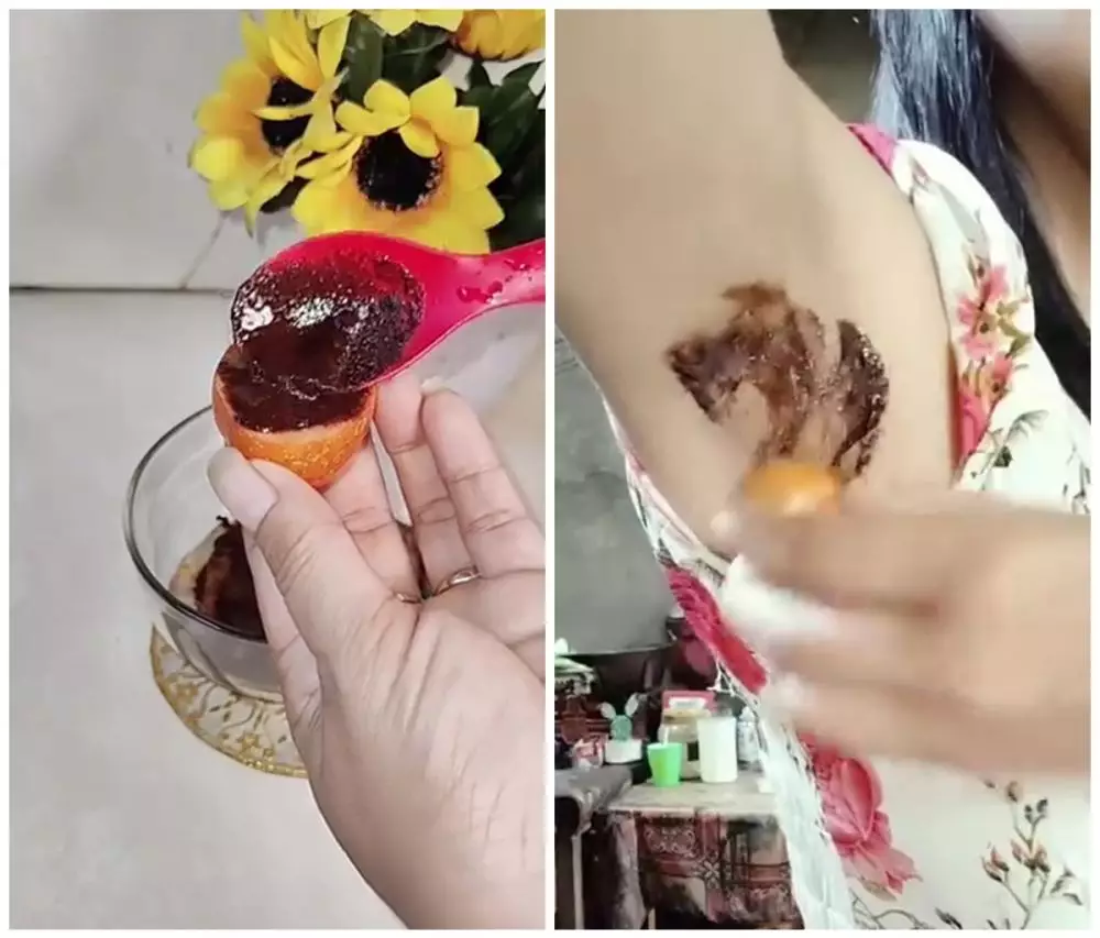 hilangkan bulu ketiak secara permanen © Instagram 