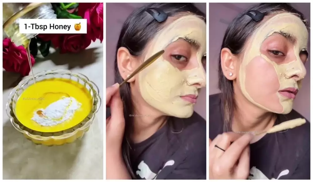 cara mengatasi bopeng © Instagram 