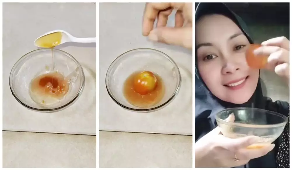 Cara mudah kenyalkan kulit © Instagram  Cara mudah kenyalkan kulit © Instagram