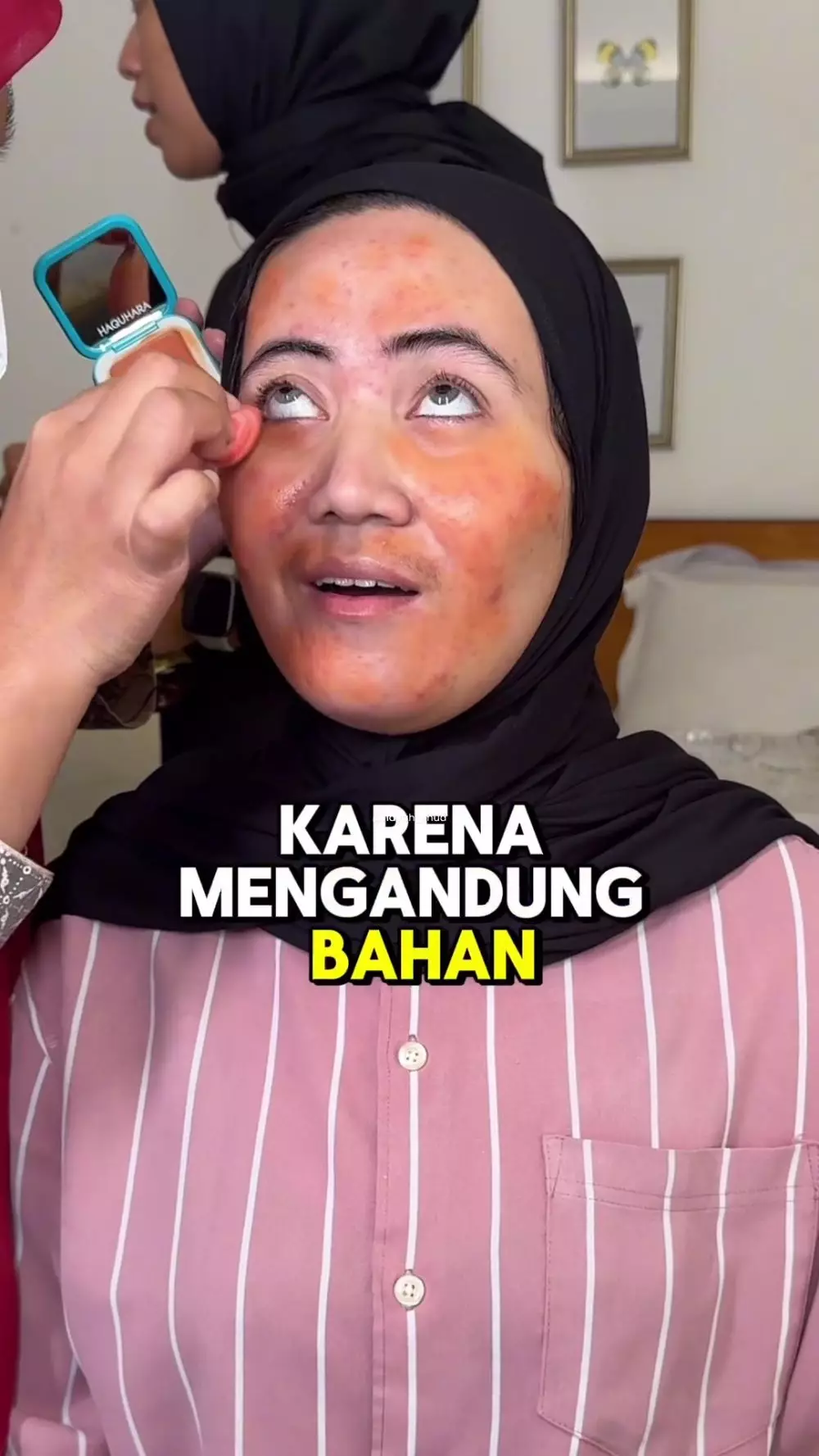 transformasi pengantin jadi mulus © Instagram transformasi pengantin jadi mulus © Instagram