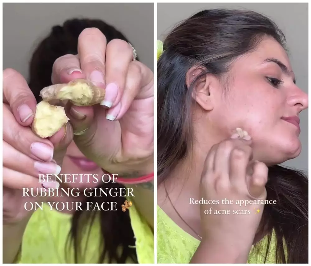jenis rempah ini bisa samarkan bekas jerawat © Instagram 