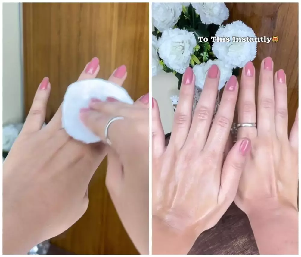 cara baru atasi punggung tangan belang © Instagram  cara baru atasi punggung tangan belang © Instagram