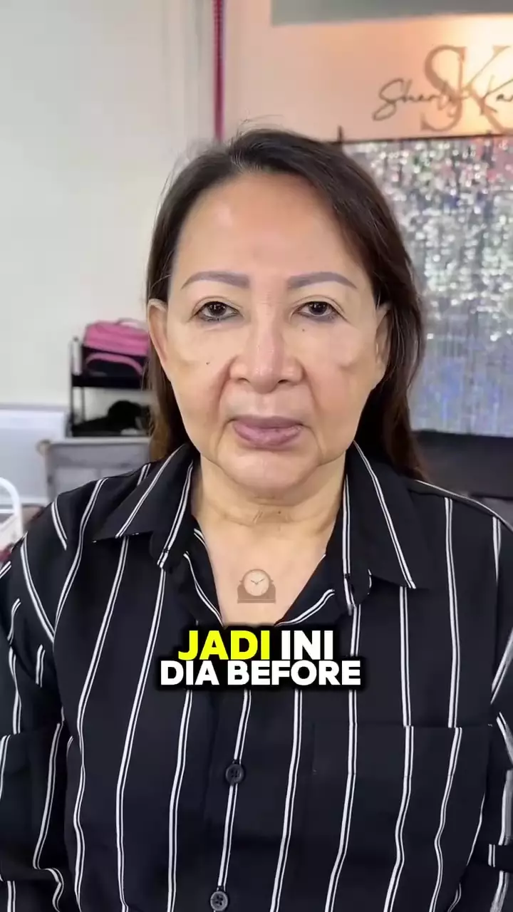 ibu-ibu berwajah kendur © Instagram 