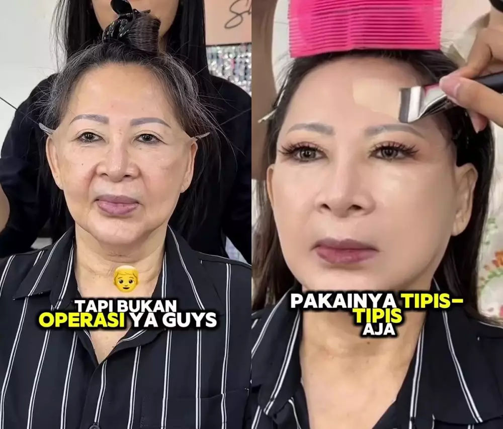 ibu-ibu berwajah kendur © Instagram 