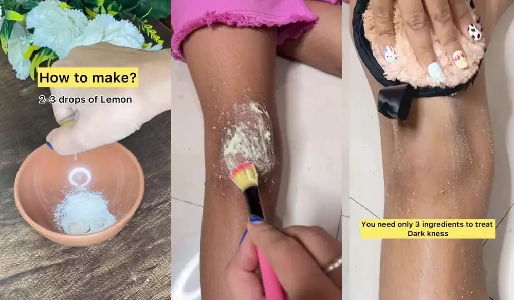 Lutut hitam dan kasar © Instagram Lutut hitam dan kasar © Instagram