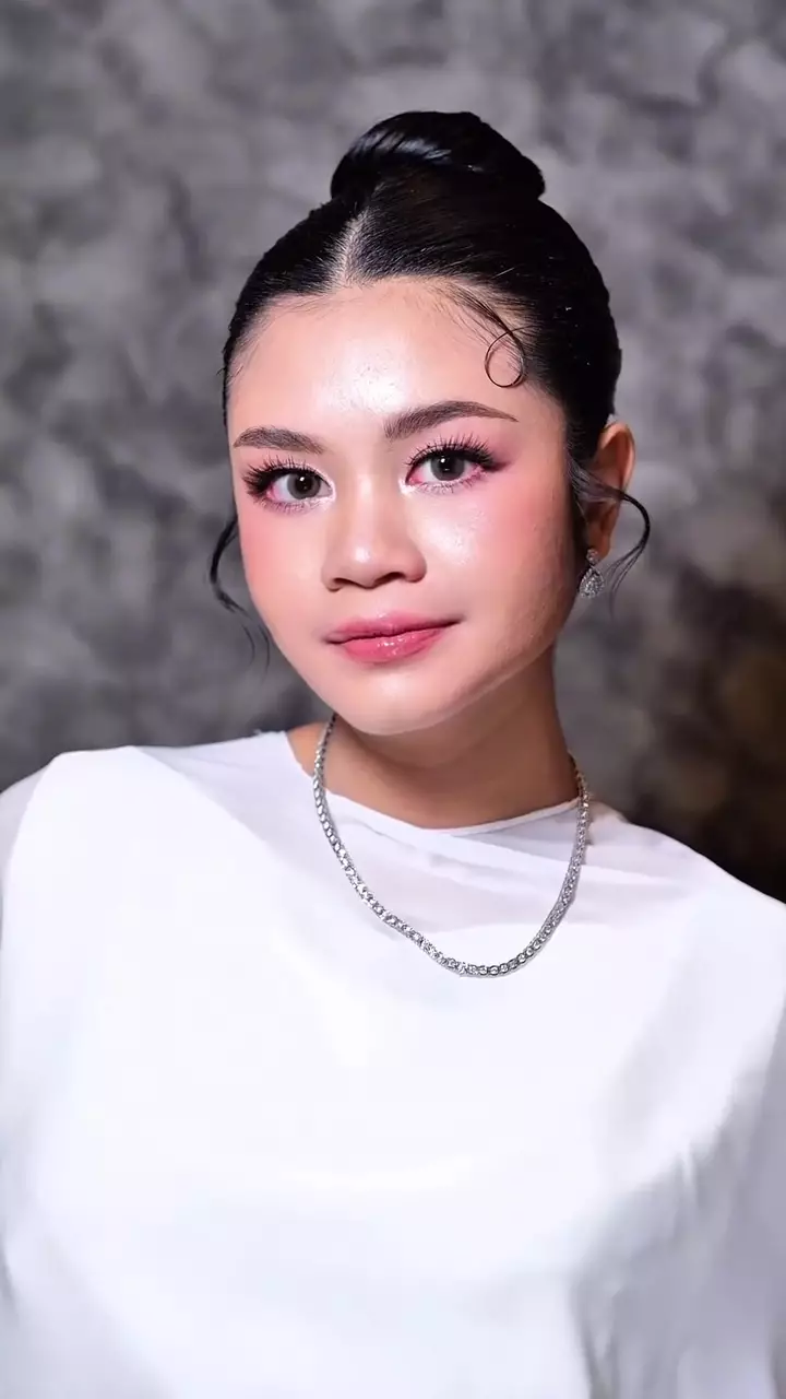 kemerahan karena bekas jerawat © Instagram