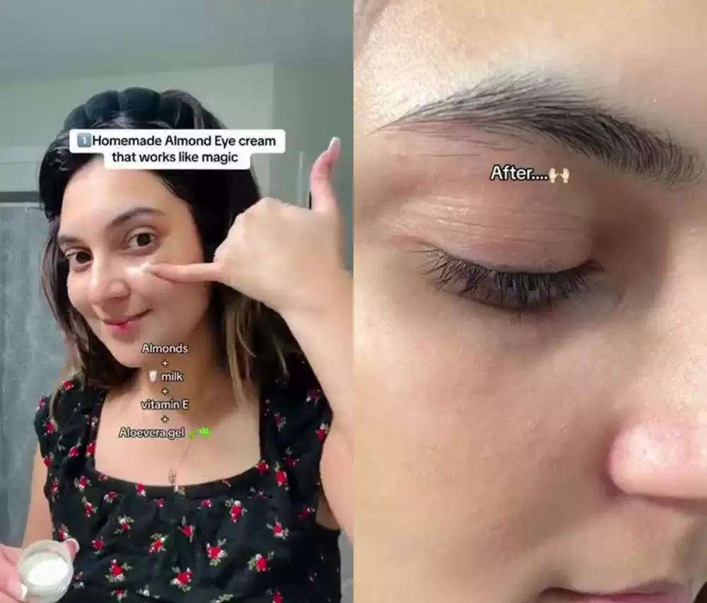 Mata panda bikin wajah lesu © Instagram Mata panda bikin wajah lesu © Instagram