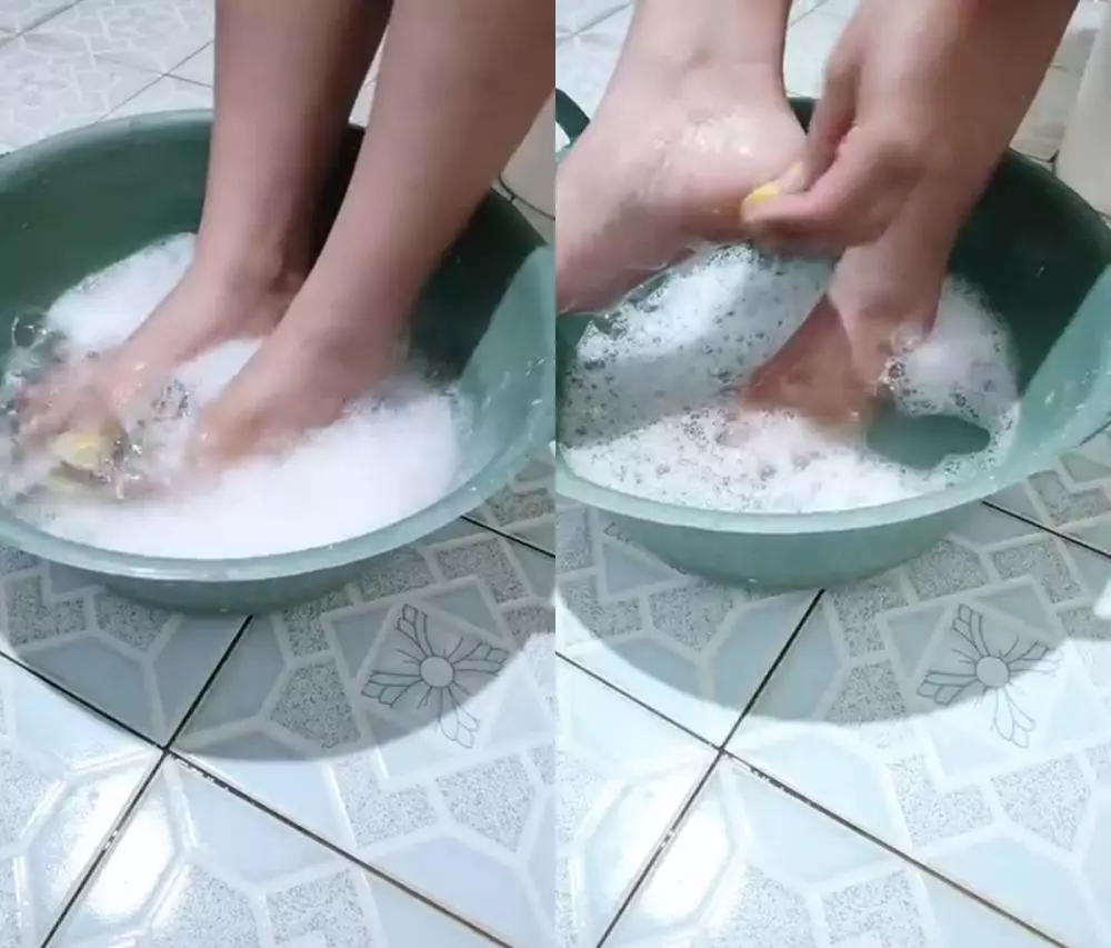 tumit kering dan pecah-pecah © Instagram tumit kering dan pecah-pecah © Instagram