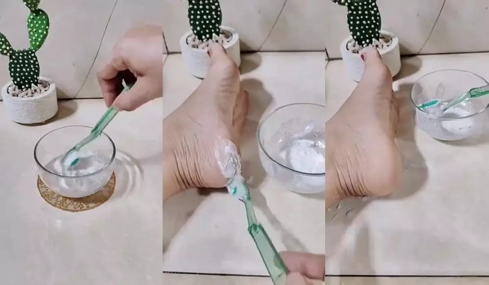 cara bikin tumit pecah-pecah © Instagram  cara bikin tumit pecah-pecah © Instagram