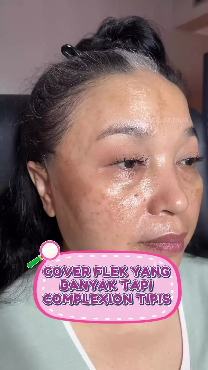 Flek hitam ter-cover © Instagram Flek hitam ter-cover © Instagram