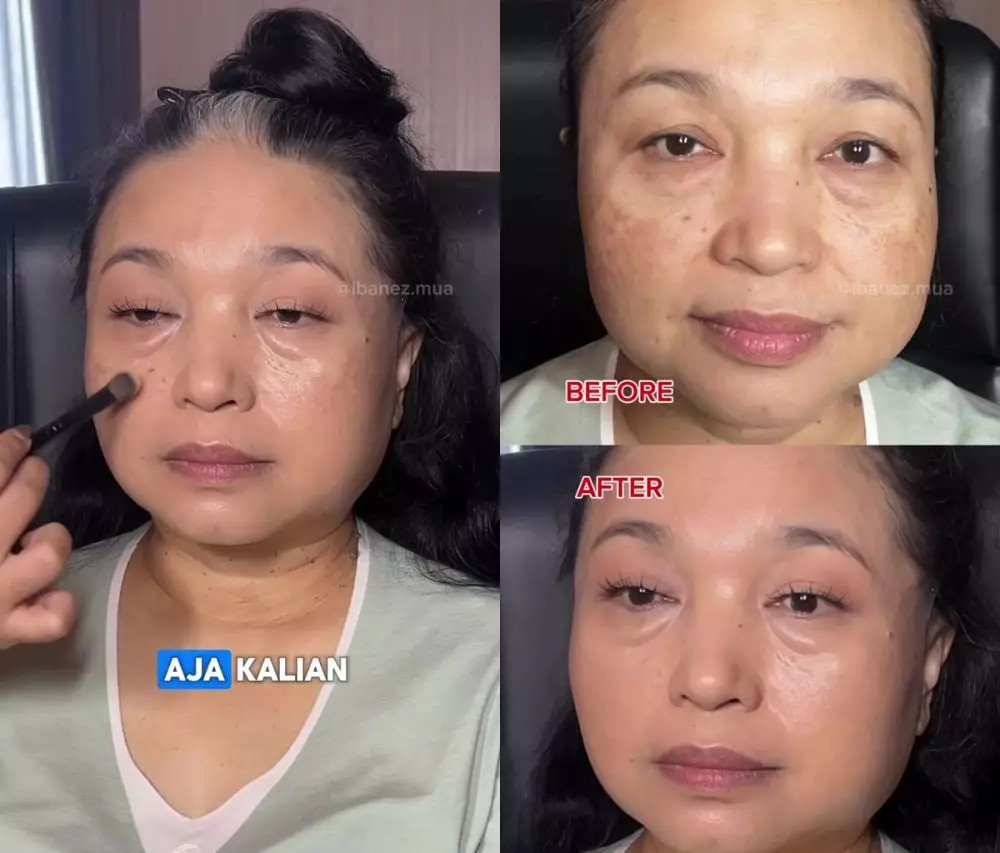 Flek hitam ter-cover © Instagram Flek hitam ter-cover © Instagram