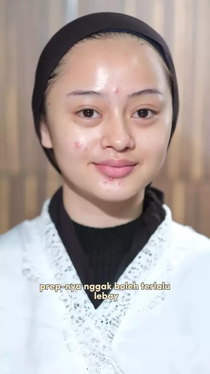 Punya jerawat aktif © Instagram