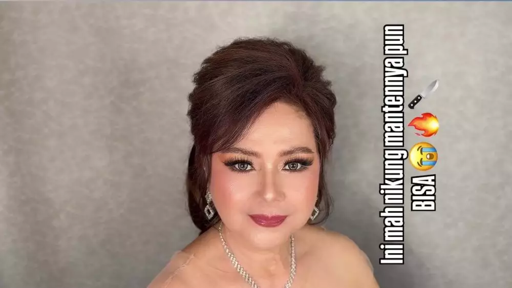 Kantung mata kendur © Instagram 