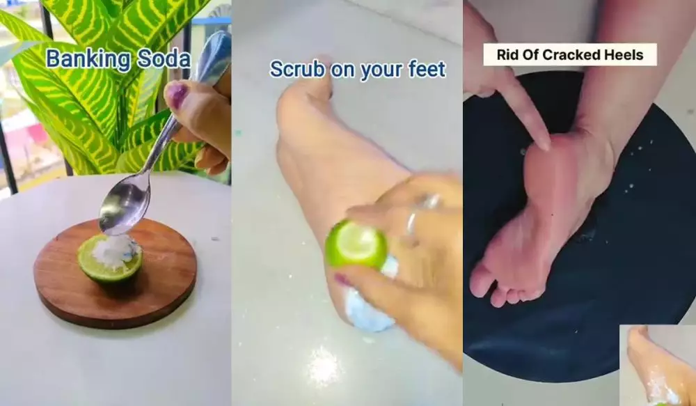 Jangan dikikis © Instagram 