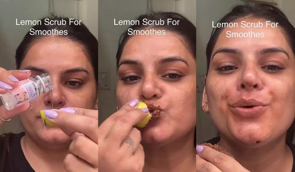 Bibir hitam akibat hiperpigmentasi © Instagram 