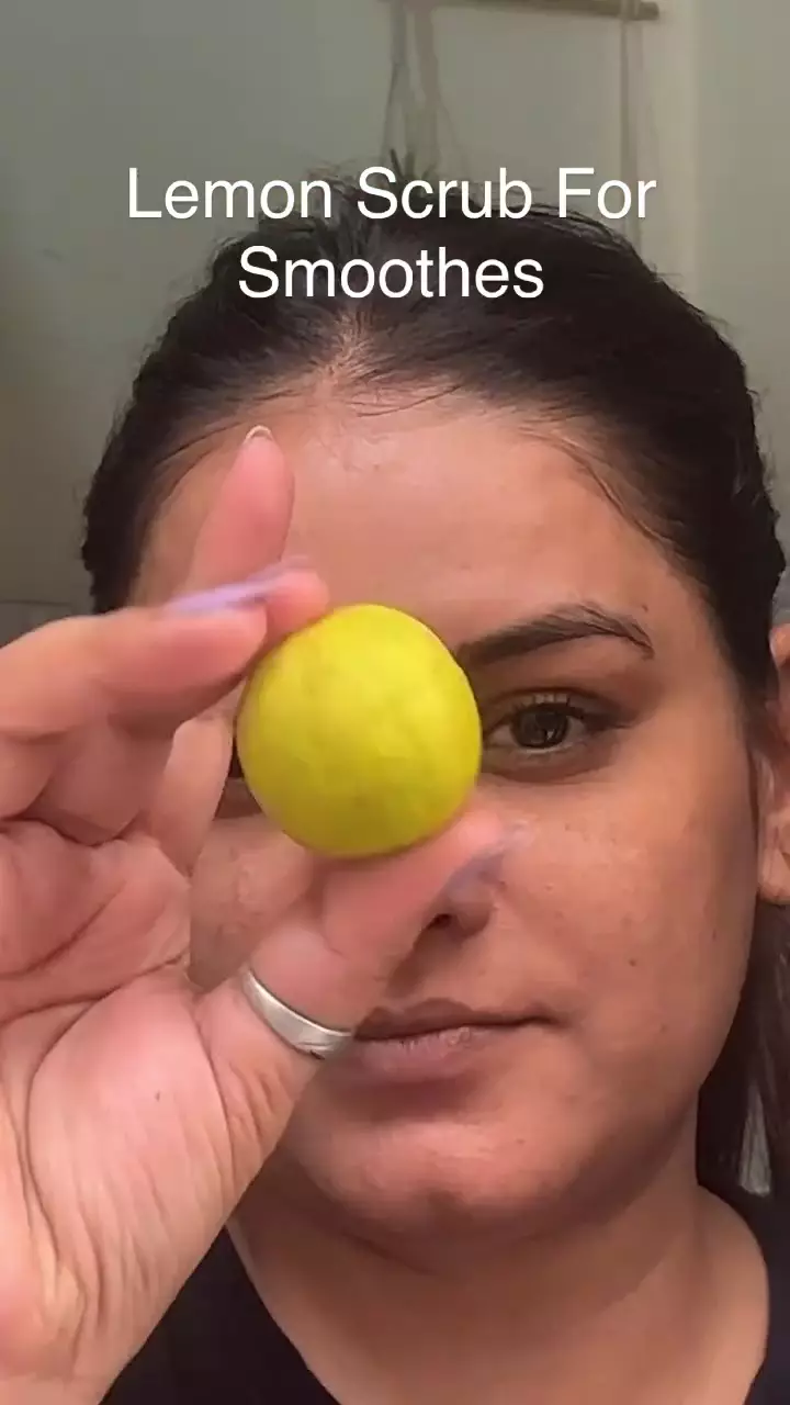 Bibir hitam akibat hiperpigmentasi © Instagram 