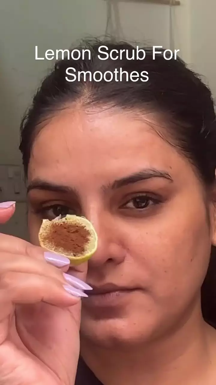 Bibir hitam akibat hiperpigmentasi © Instagram 