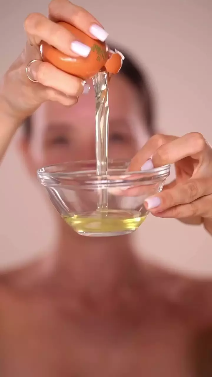 Bukan dikompres es batu © Instagram