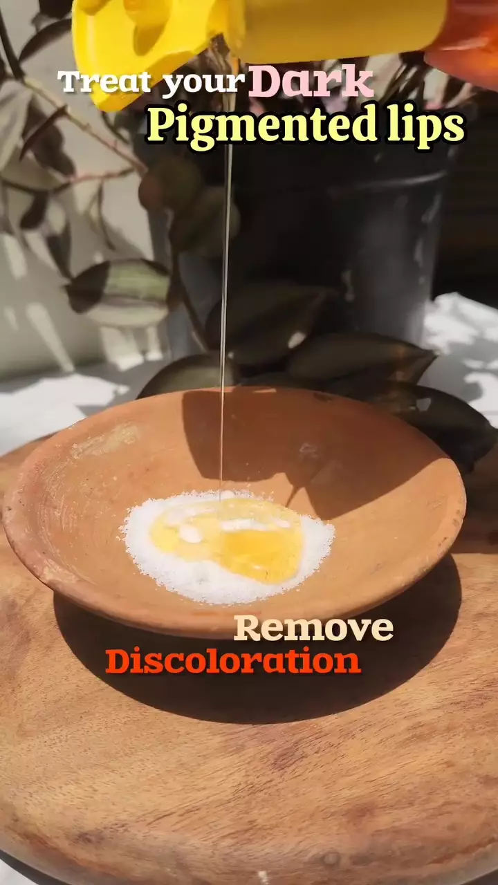 Bibir gelap dan kering © Instagram