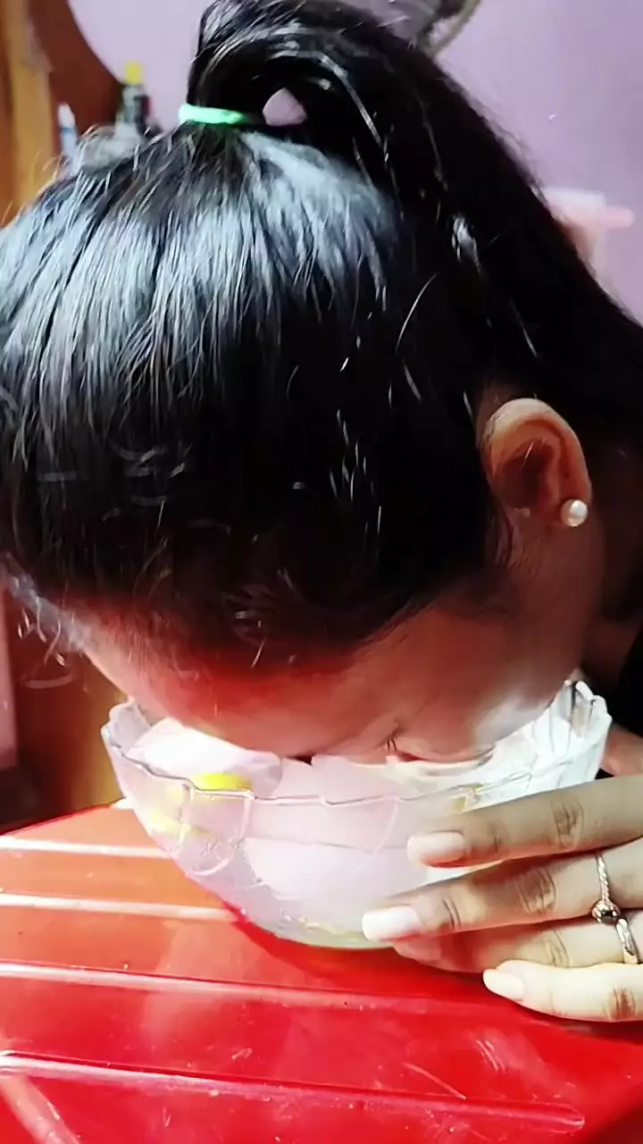 Tak perlu treatment mahal © Instagram