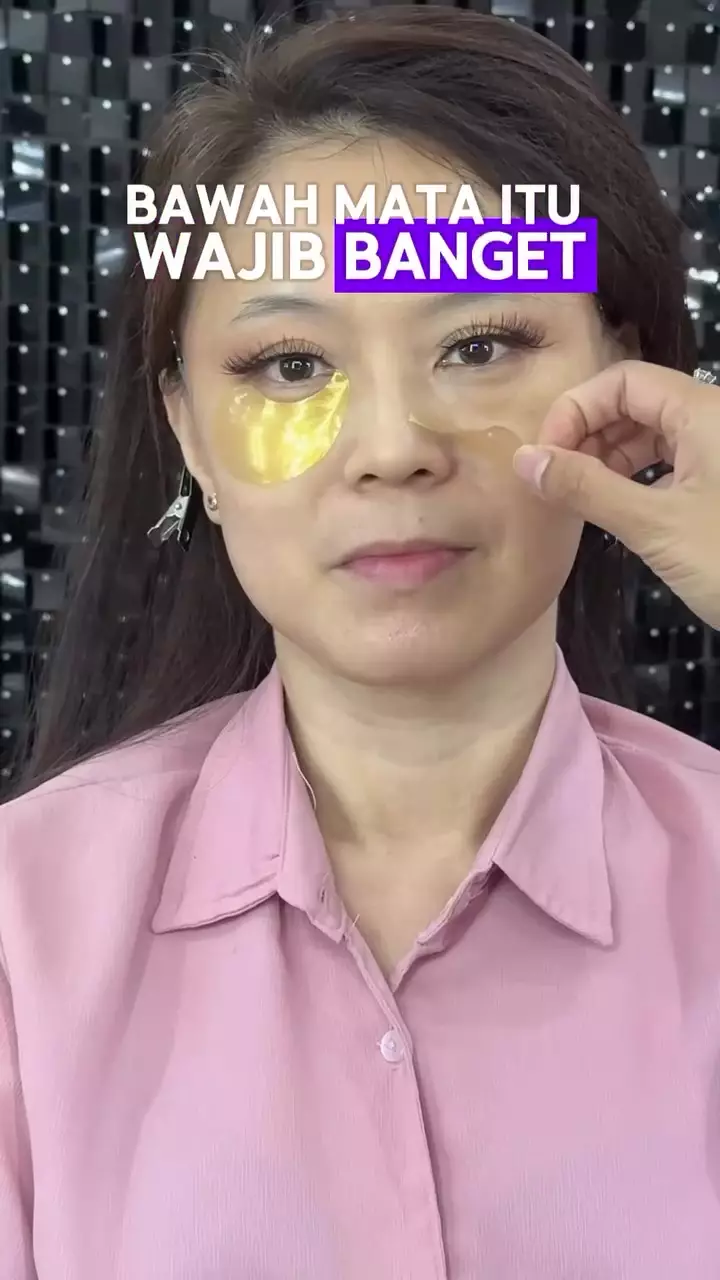 Garis halus bawah mata © Instagram