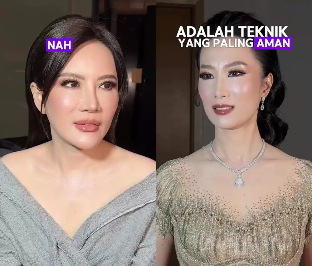 Garis halus bawah mata © Instagram