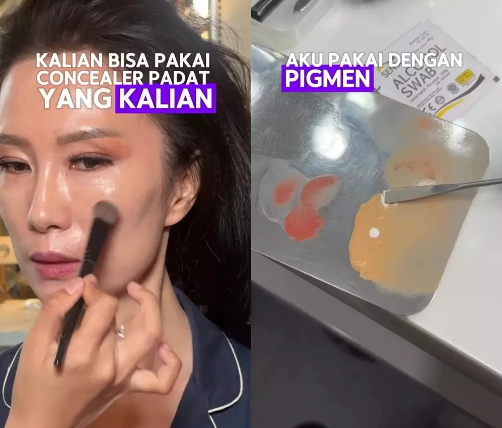 Garis halus bawah mata © Instagram