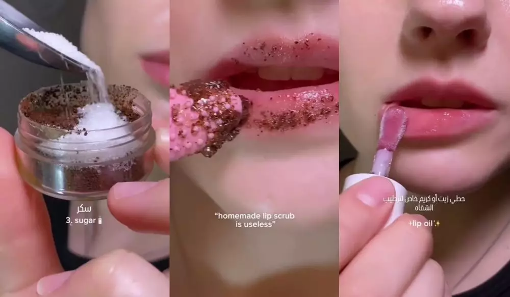 Ingin bibir plumpy © Instagram