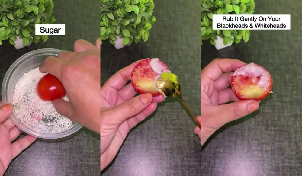 Pori-pori kotor © Instagram 