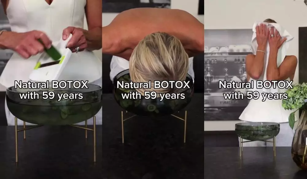 trik botox natural © Instagram 
