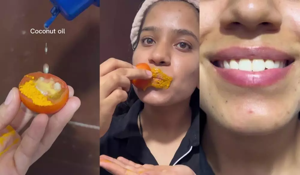 Ingin punya bibir lembap © Instagram 