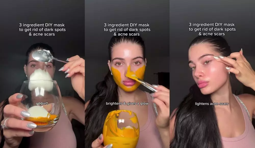 Tak perlu laser jutaan rupiah © Instagram 