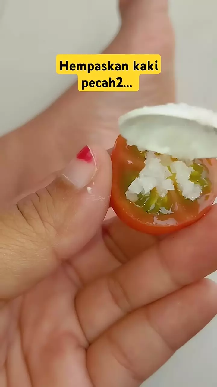 Tak ada lagi tumit kasar © YouTube