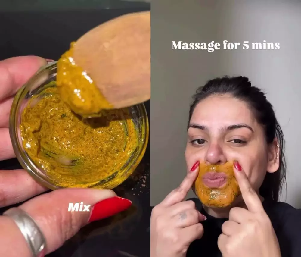 Area sekitar bibir menghitam © Instagram