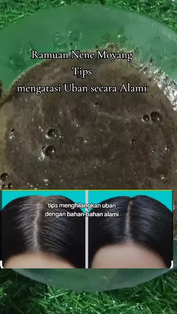 Solusi mengatasi uban © Instagram 