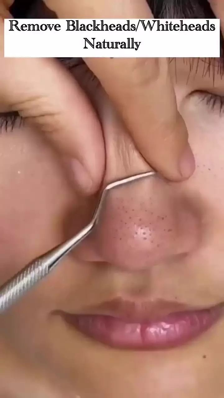 Cara mengecilkan pori-pori © Instagram 