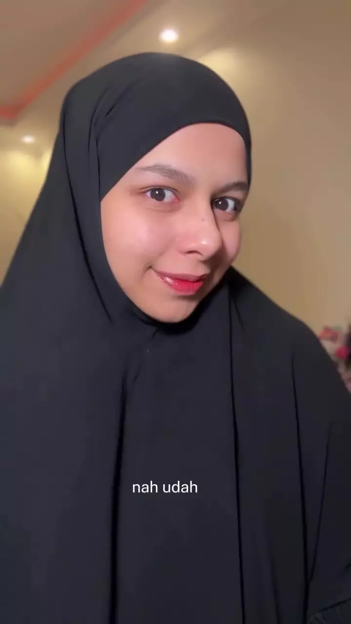 Asal pakai bisa bikin breakout © Instagram 