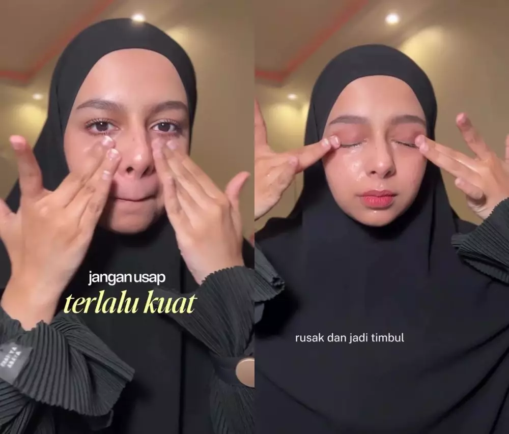 Asal pakai bisa bikin breakout © Instagram 