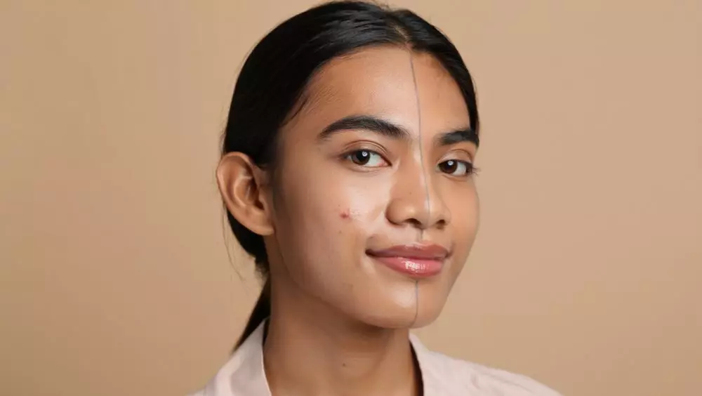 Rekomendasi makeup terbaik untuk menutupi bruntusan © 2025 brilio.net