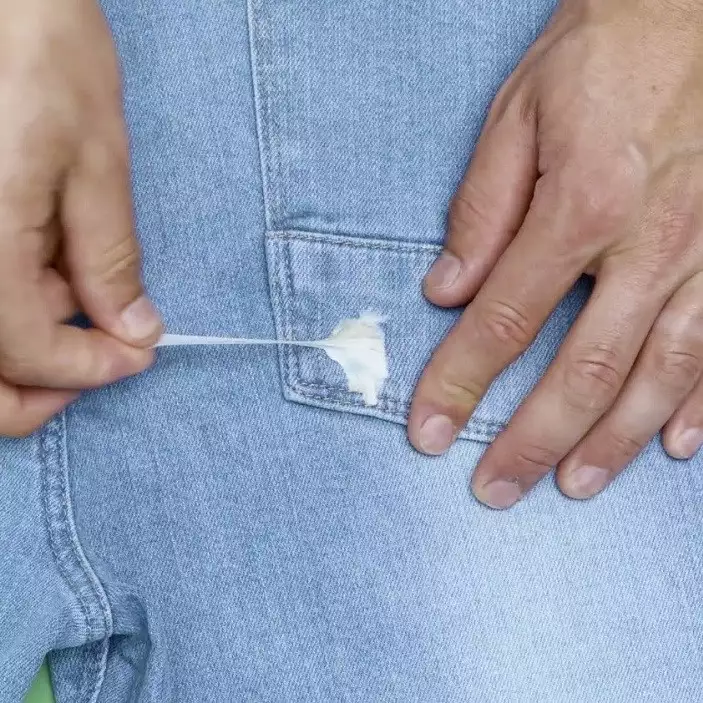 Tips simpel hilangkan permen karet yang nempel di baju
