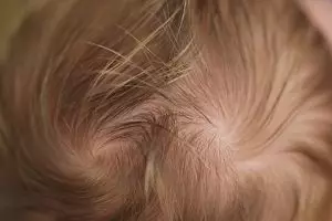 Benarkah anak punya dua pusar kepala itu nakal? Ini penjelasannya